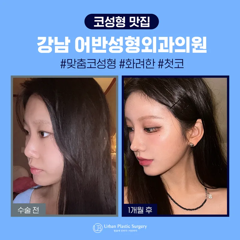 Urban Plastic Surgery Clinic