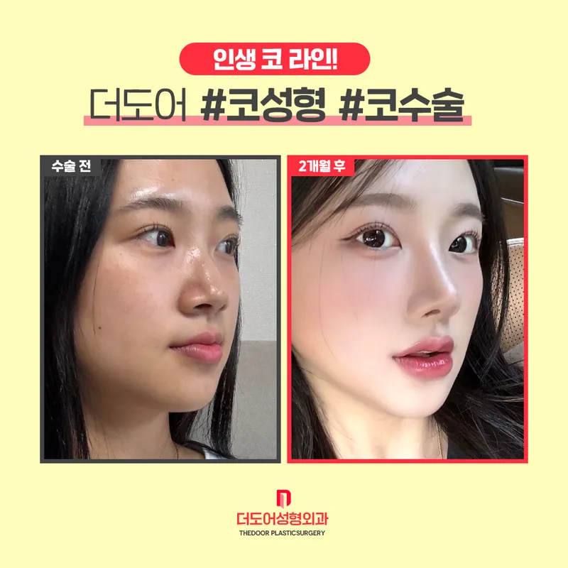 DooDoo Plastic Surgery Clinic