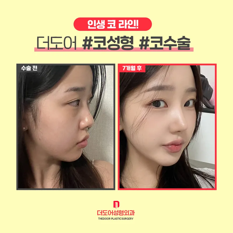 DooDoo Plastic Surgery Clinic