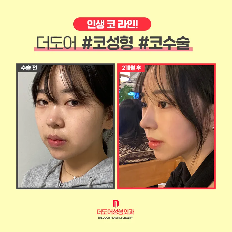DooDoo Plastic Surgery Clinic