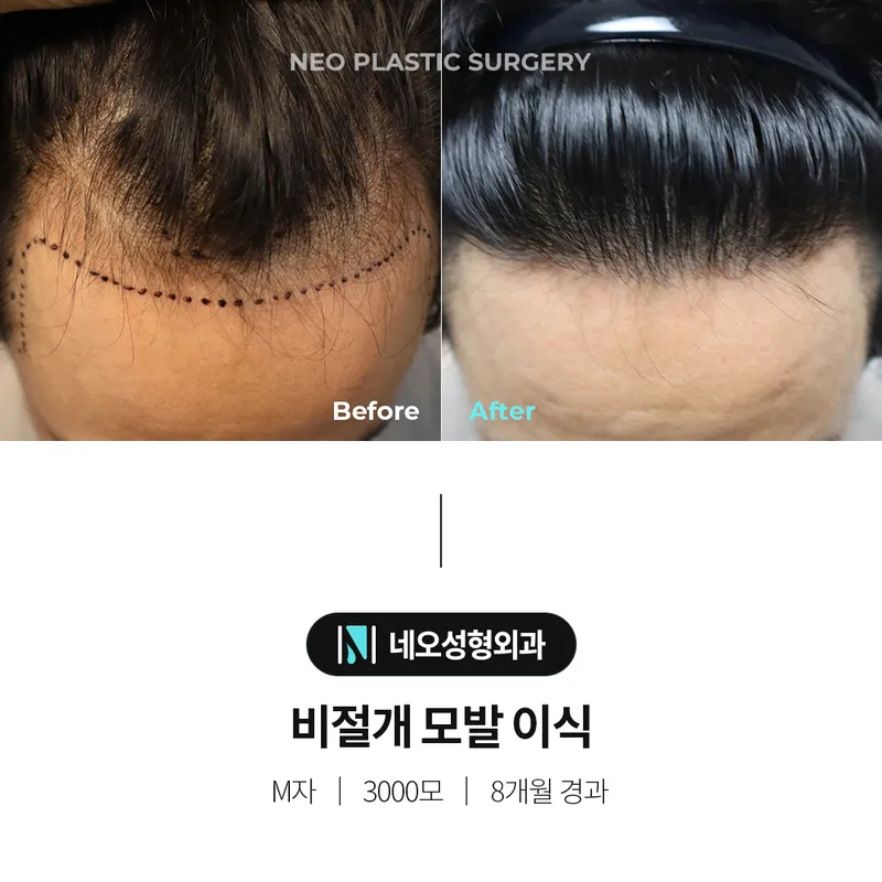 Neo Plastic Surgery Clinic