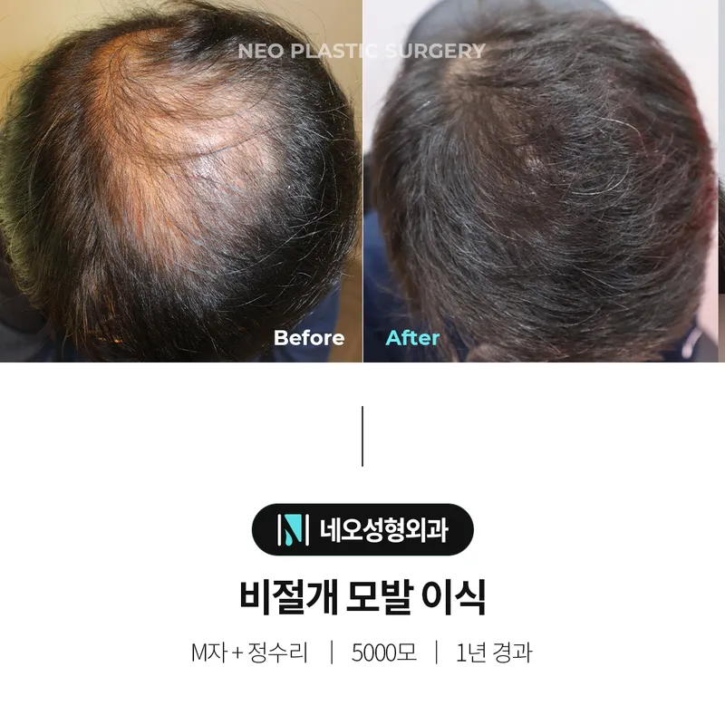 Neo Plastic Surgery Clinic