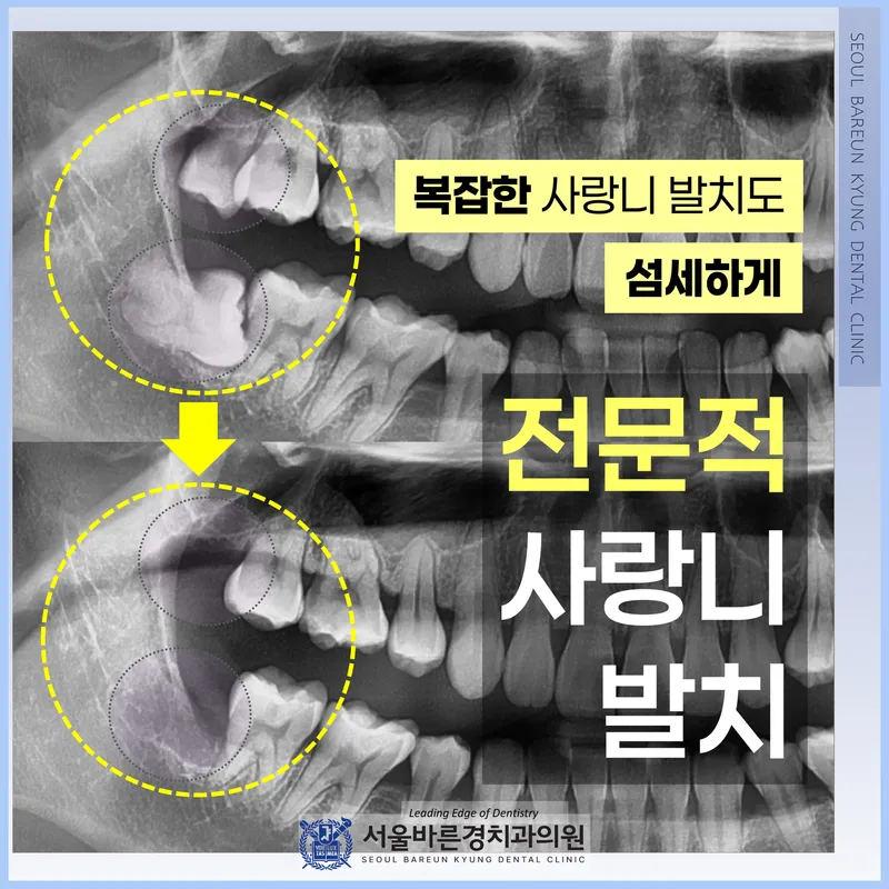 서울바른경치과의원