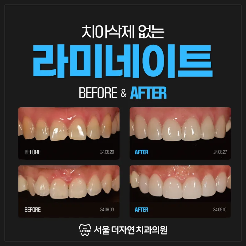Seoul The Natural Dentist