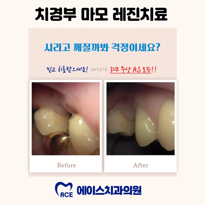 Ace Dental Clinic Yeongdeungpo Mungyeoldong Branch