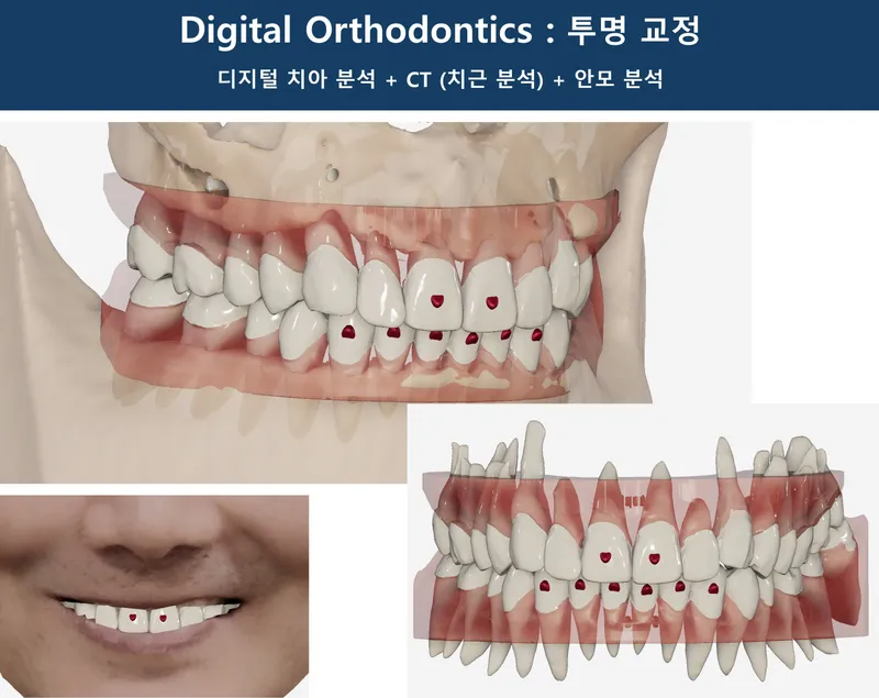 Seonung Wellchi Dental Clinic