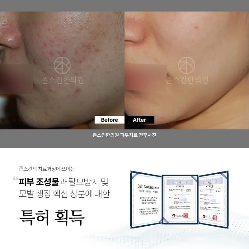 Joneskin Korean Medicine Clinic