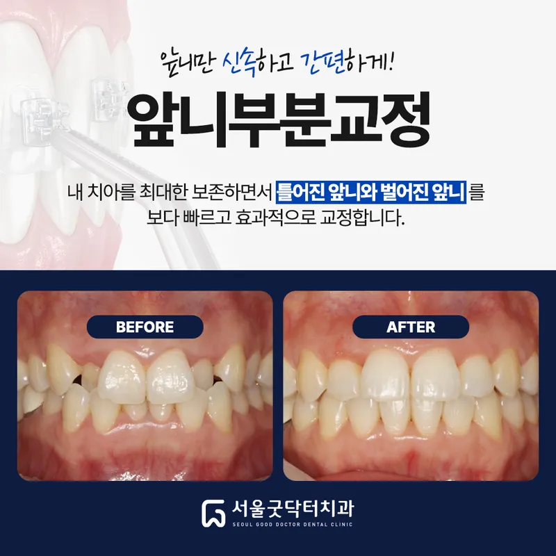서울굿닥터치과의원