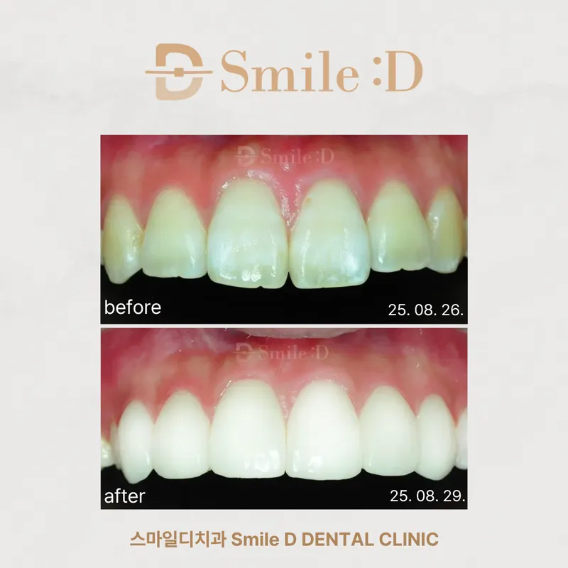 Smile Ditchi Dental Clinic Gangnam