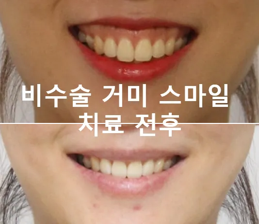 Central Dental Clinic Gangnam Branch