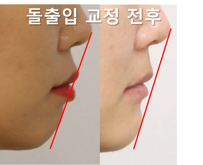 Central Dental Clinic Gangnam Branch