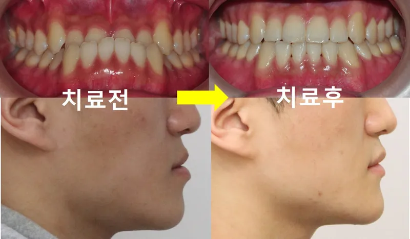 Central Dental Clinic Gangnam Branch