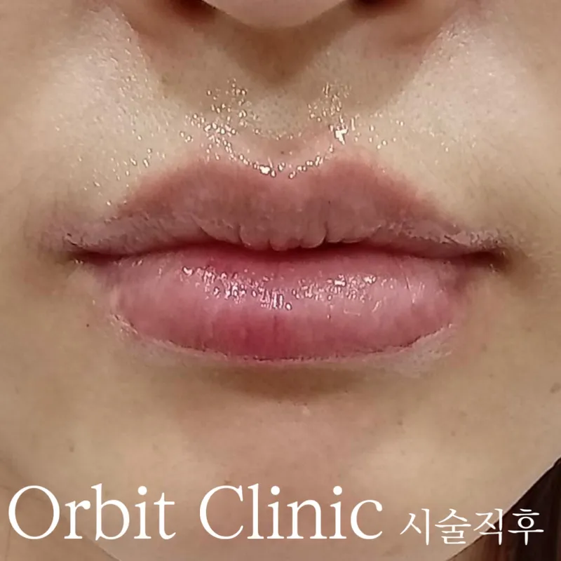 Obit Clinic