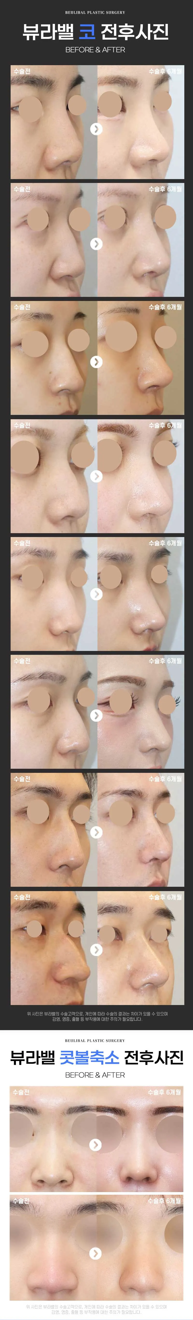 Bevall Plastic Surgery Clinic