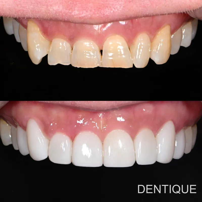 Dentique Clinic Gangnam