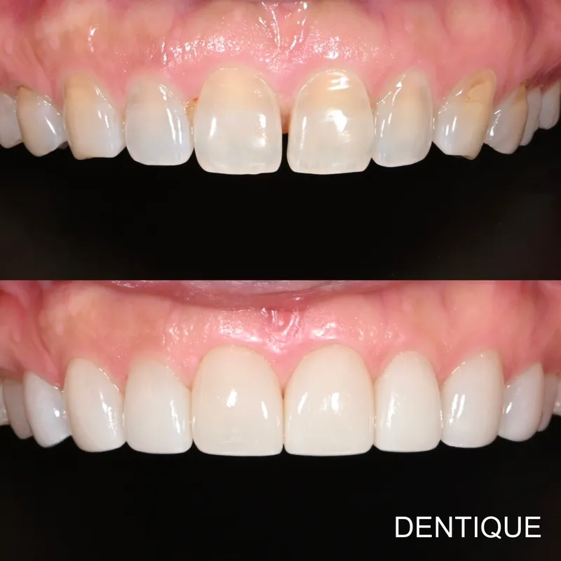 Dentique Clinic Gangnam