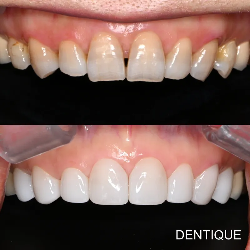Dentique Clinic Gangnam
