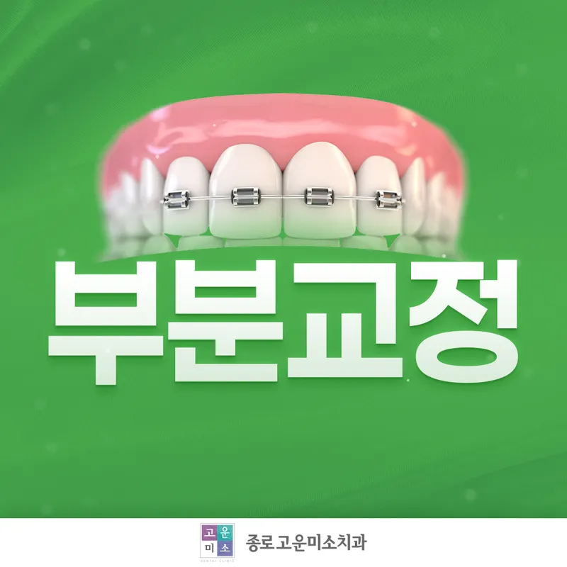 연세고운미소치과의원 종로점