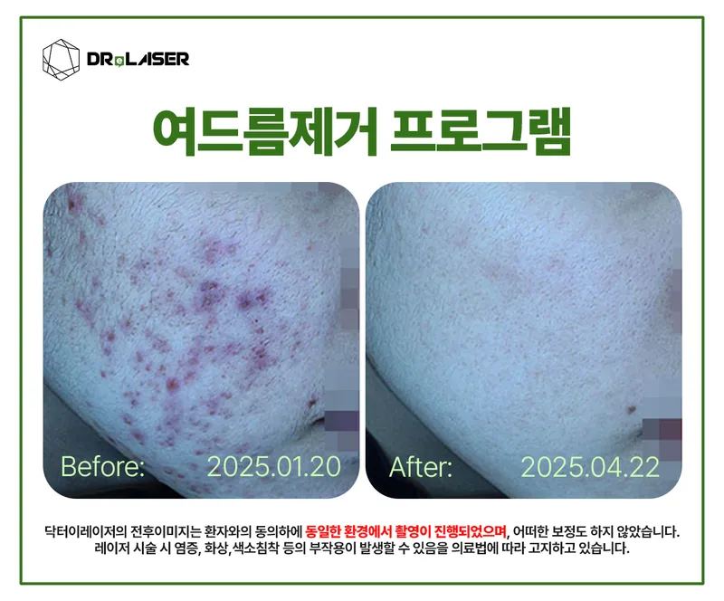 Dr. I Laser Dermatology Clinic