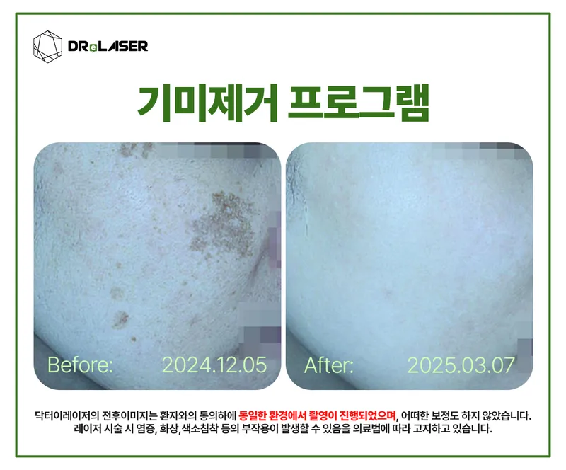 Dr. I Laser Dermatology Clinic