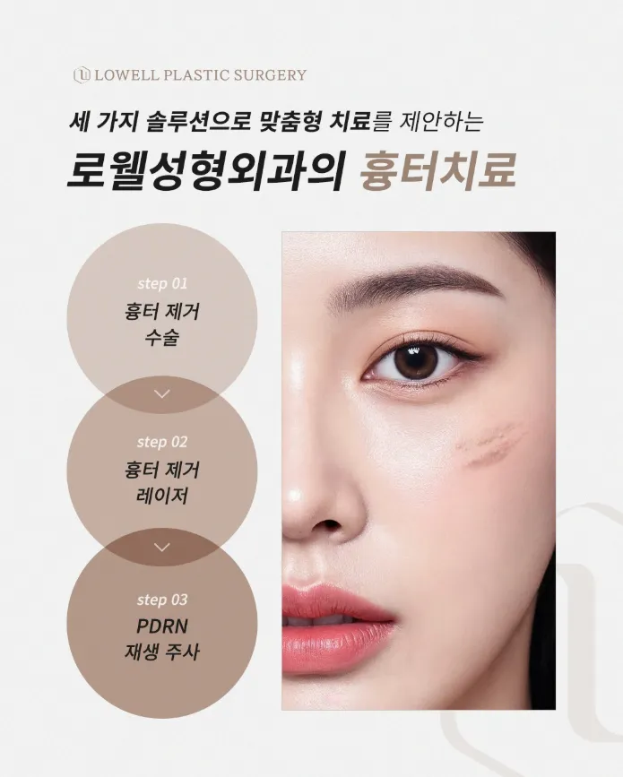 Loewell Plastic Surgery Gangnam Branch