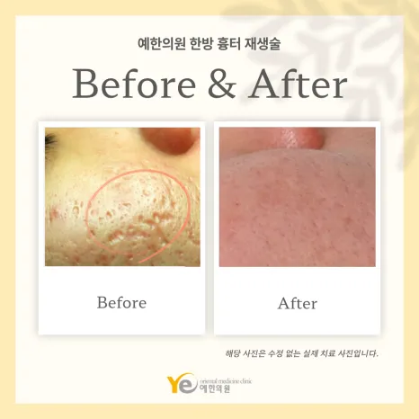Yea Korean Medicine Clinic