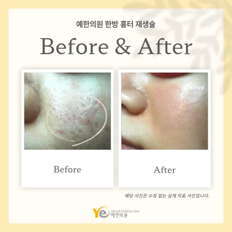Yea Korean Medicine Clinic