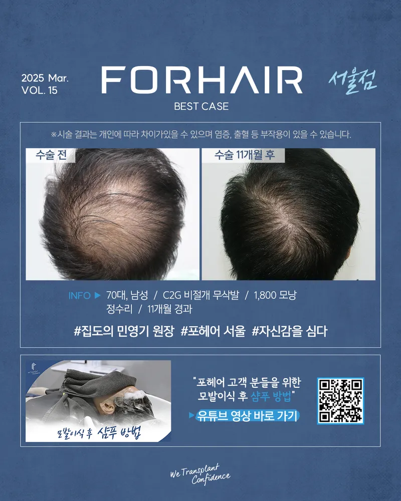 PO Hair Clinic Seoul