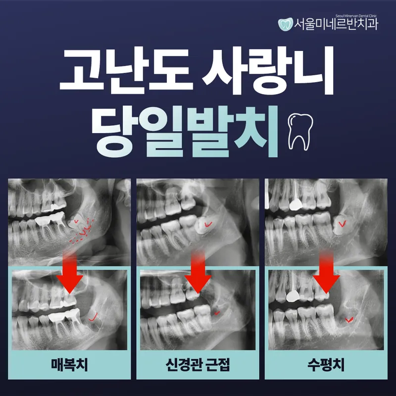 서울미네르반치과의원