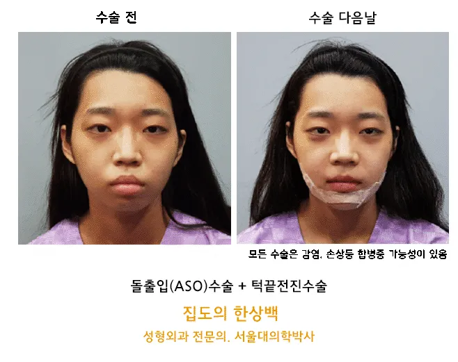 Seoul First Plastic Surgery Clinic