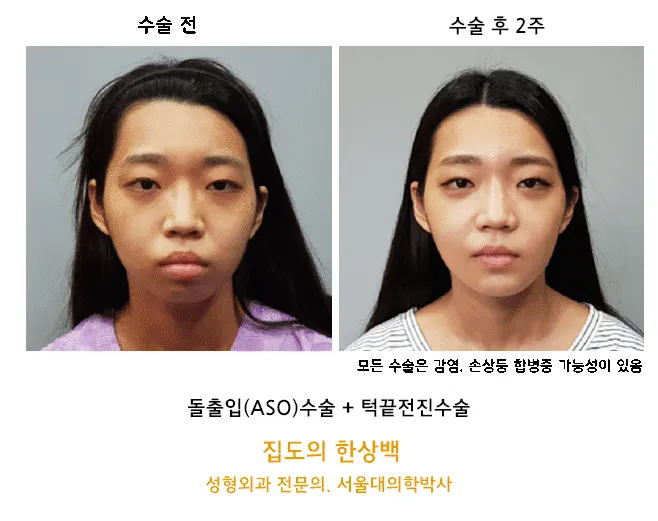 Seoul First Plastic Surgery Clinic