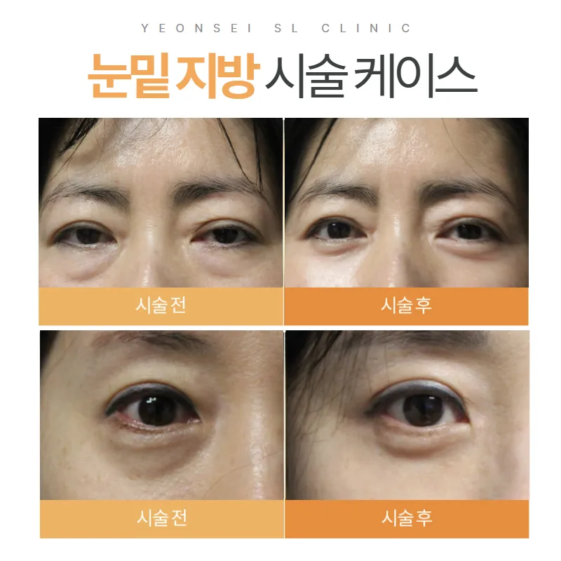 Yonsei SL Clinic