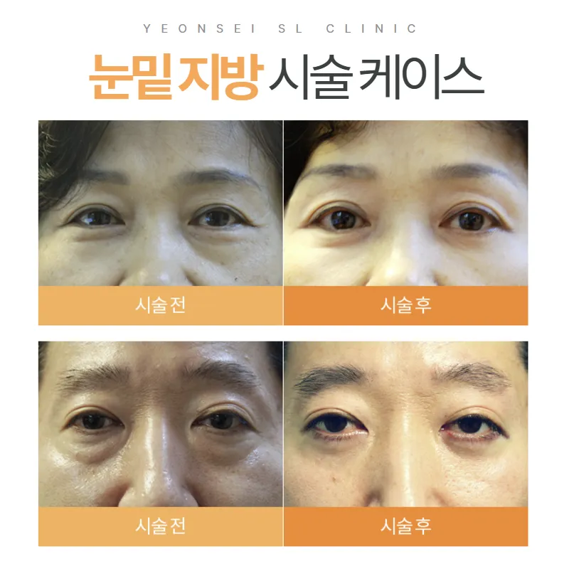 Yonsei SL Clinic