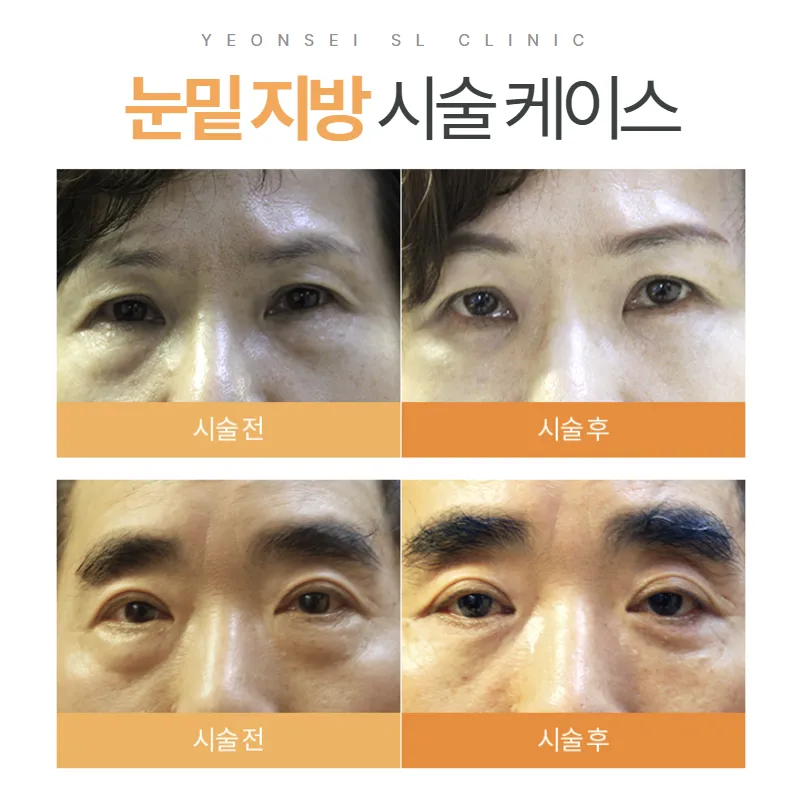Yonsei SL Clinic