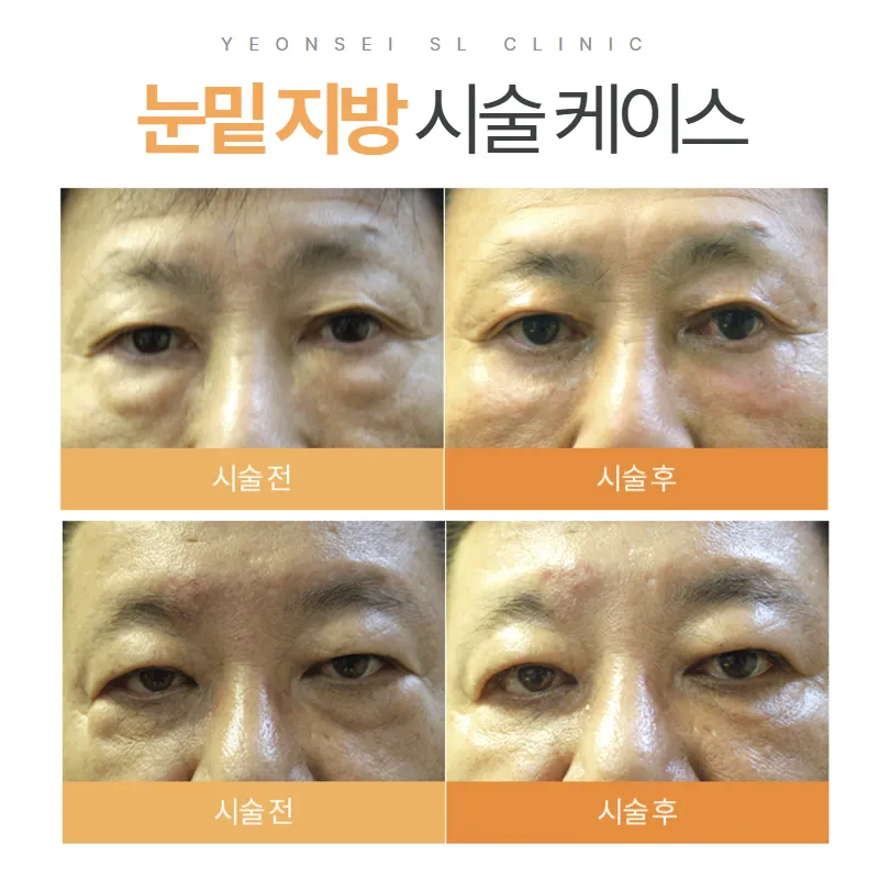 Yonsei SL Clinic