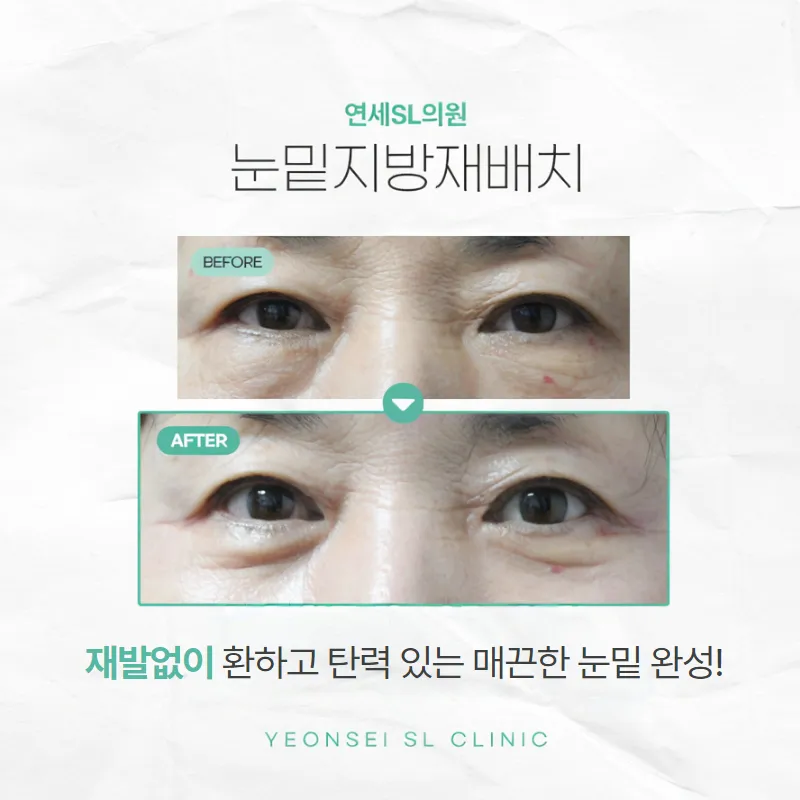 Yonsei SL Clinic