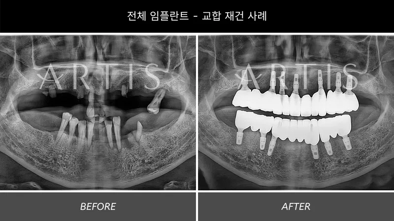 아티스치과의원 왕십리