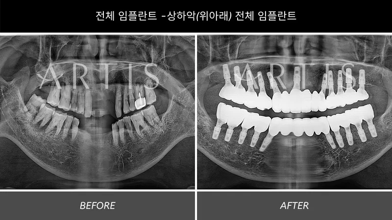 아티스치과의원 왕십리