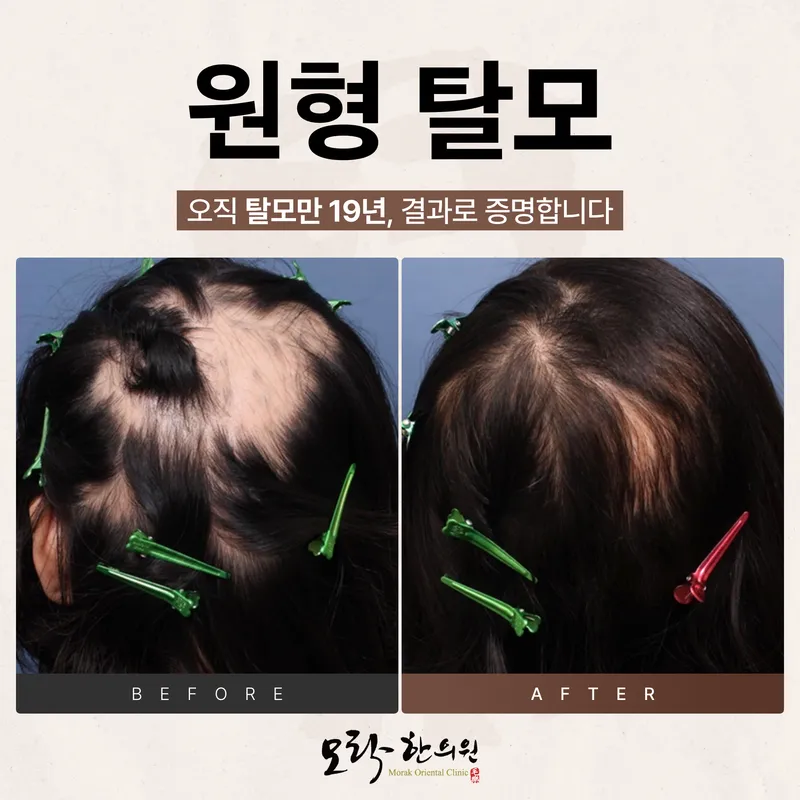 Morak Korean Medicine Clinic