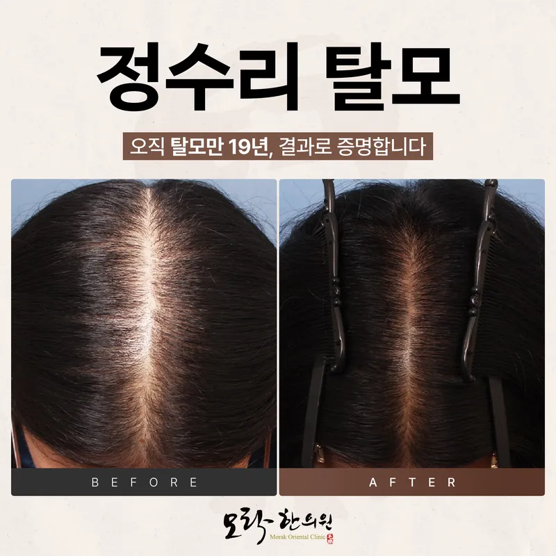 Morak Korean Medicine Clinic