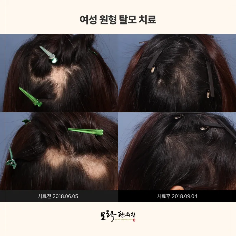 Morak Korean Medicine Clinic