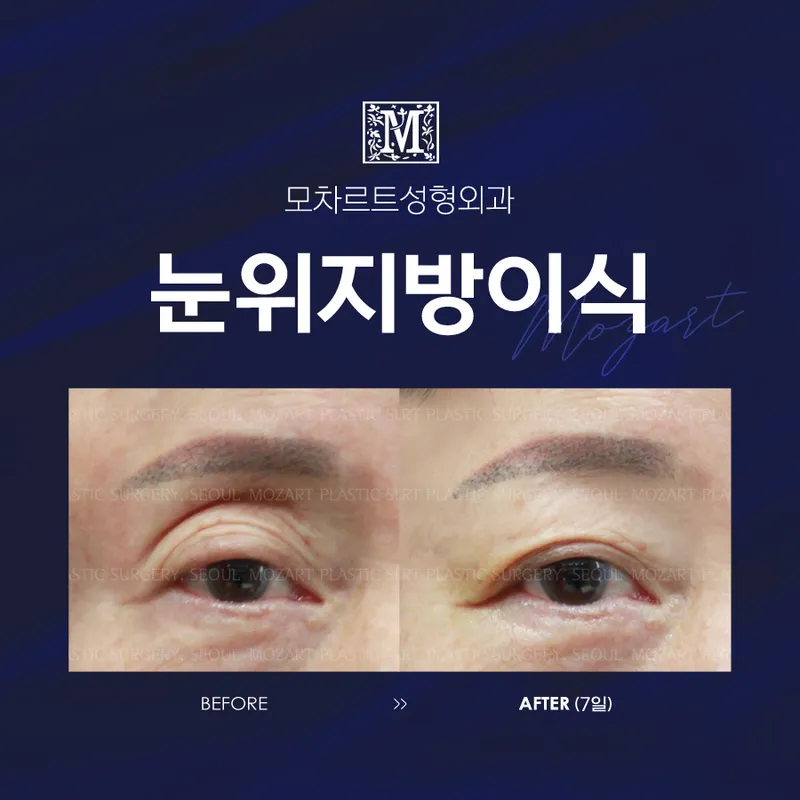 Mozart Plastic Surgery Clinic