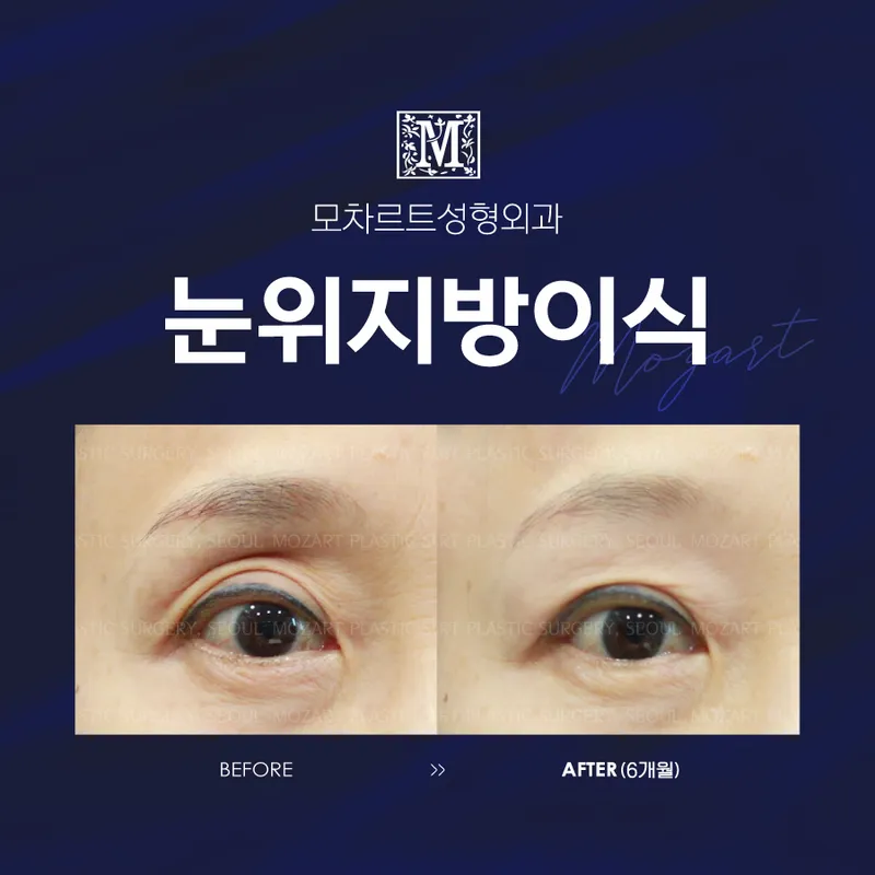 Mozart Plastic Surgery Clinic
