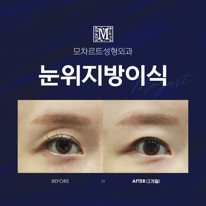 Mozart Plastic Surgery Clinic