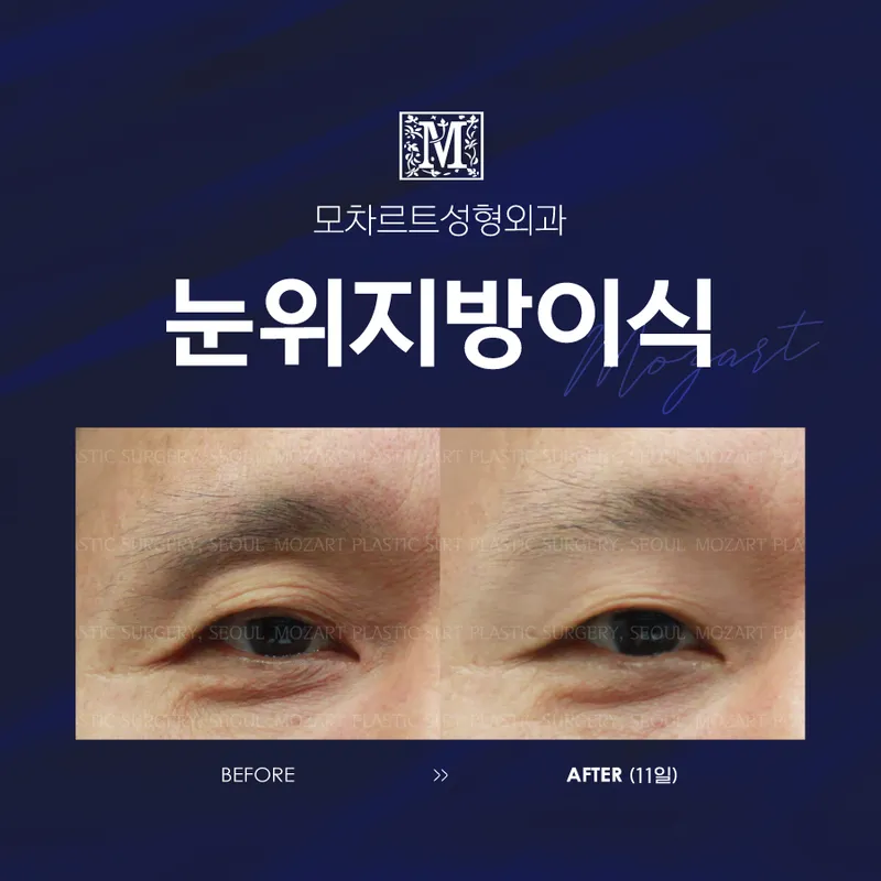 Mozart Plastic Surgery Clinic
