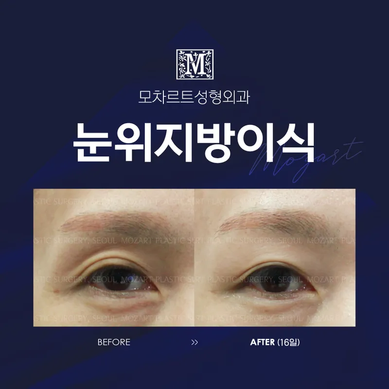 Mozart Plastic Surgery Clinic