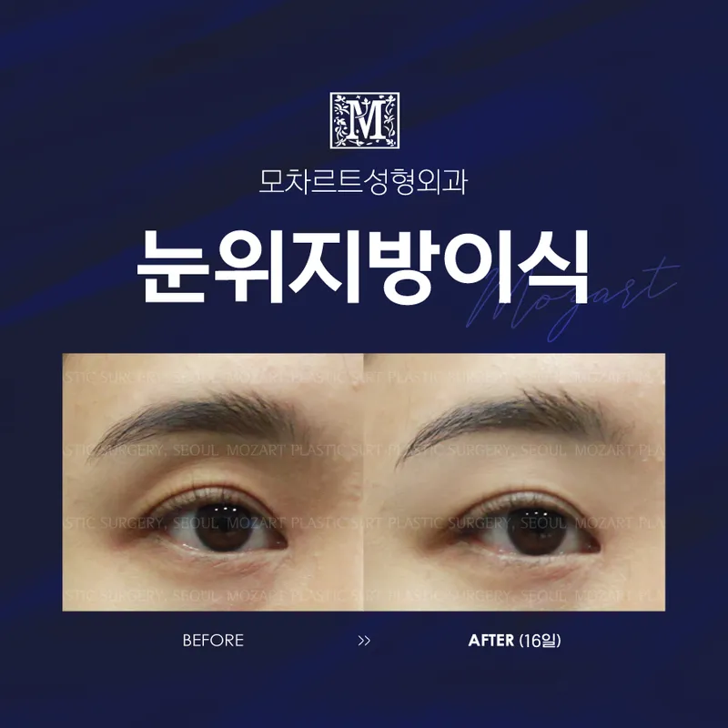 Mozart Plastic Surgery Clinic