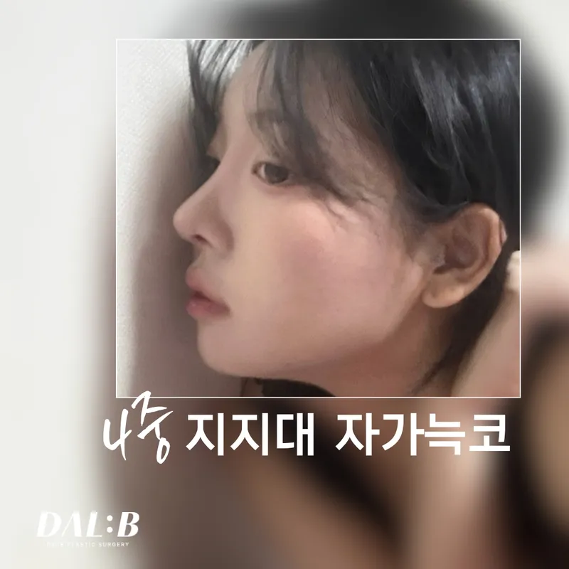DaeBi Plastic Surgery Clinic