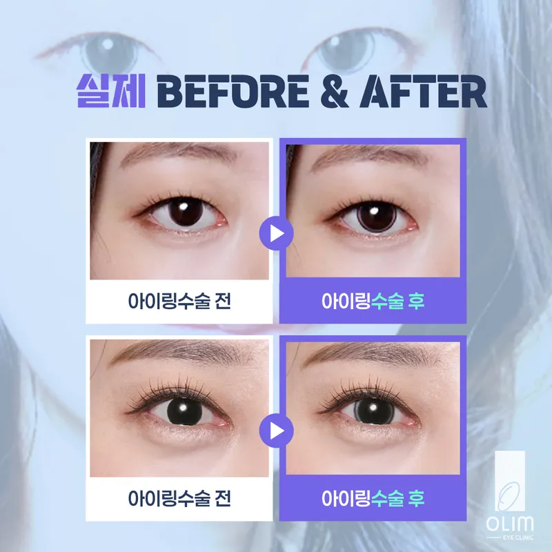 Allim Eye Clinic