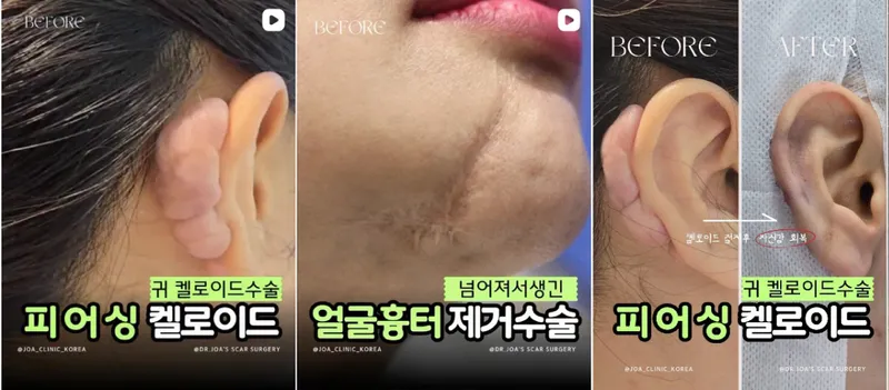 조아성형외과의원
